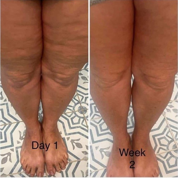 3 TUBES! AgeLOC Dermatic Effects Nuskin - Picture 15 of 16